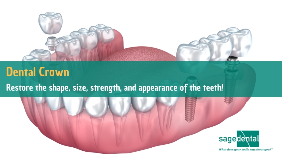 dental-crown-to-restore-the-natural-appearance-of-the-teeth
